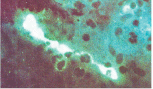 యూరప్‌ను వణికిస్తున్న ప్యారట్‌ ఫీవర్‌